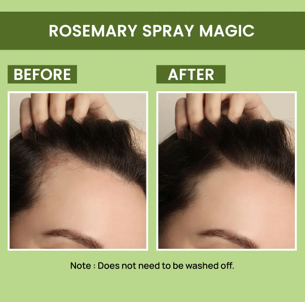 Rosemary Water, Hair Spray For Regrowth [Buy 1 Get 1 Free]